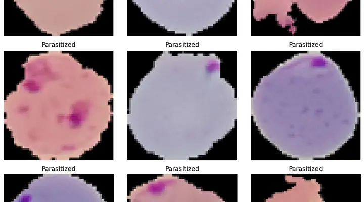 Malaria Detection Capstone